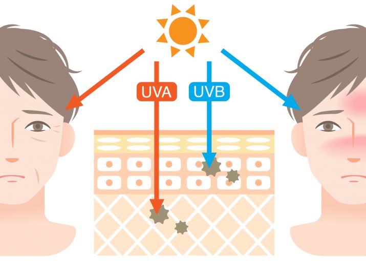 UVが肌に与える影響